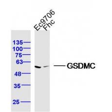 Anti-GSDMC antibody