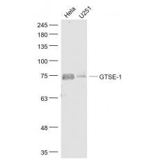 Anti-GTSE-1 antibody