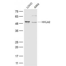 Anti-HHLA2 antibody
