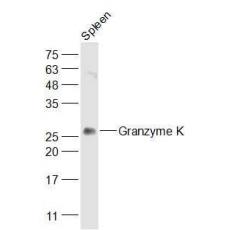 Anti-Granzyme K antibody