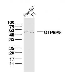 Anti-GTPBP9 antibody