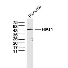 Anti-HIAT1 antibody