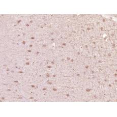 Anti-HIPK1 antibody