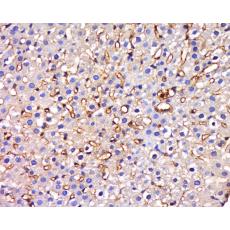 Anti-HIATL1 antibody
