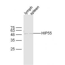 Anti-HIP55 antibody