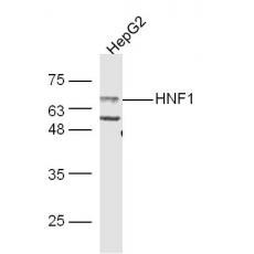 Anti-HNF1A antibody
