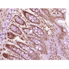 Anti-hnRNP A2B1 antibody