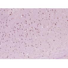 Anti-HOXA6 antibody