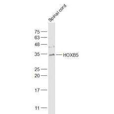 Anti-HOXB5 antibody