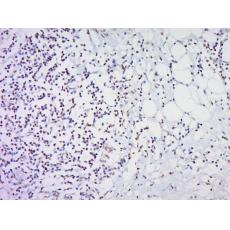 Anti-HOXc8 antibody