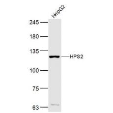 Anti-HPS2 antibody