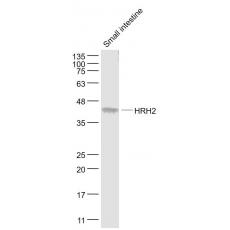 Anti-HRH2 antibody