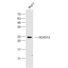 Anti-HOXD12 antibody