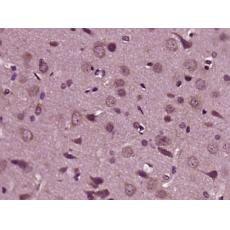 Anti-HRG beta 1 antibody