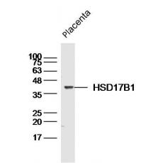 Anti-HSD17B1 antibody