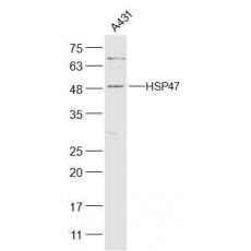 Anti-HSP47 antibody