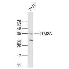 Anti-ITM2A antibody