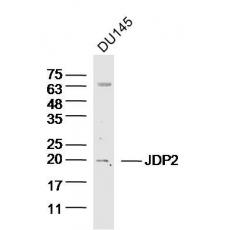 Anti-JDP2 antibody