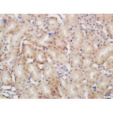 Anti-JMJD6 antibody