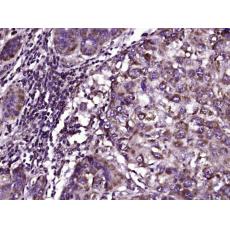 Anti-KATNA1 antibody