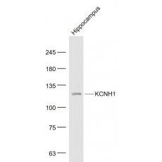 Anti-KCNH1 antibody