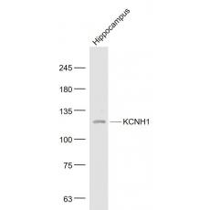 Anti-KCNH1 antibody