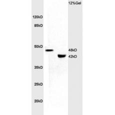 Anti-KCNN4 antibody