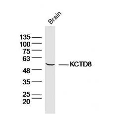 Anti-KCTD8 antibody