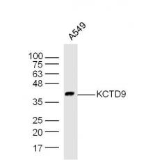 Anti-KCTD9 antibody
