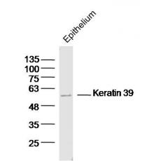 Anti-Keratin 39 antibody