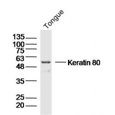 Anti-Keratin 80 antibody
