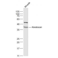 Anti-Keratocan antibody