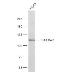 Anti-KIAA1522 antibody