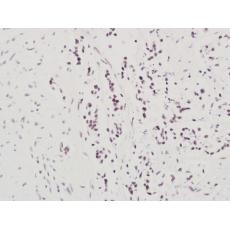 Anti-NARG1 antibody