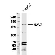 Anti-NAV2 antibody