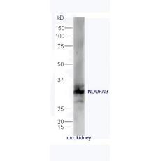 Anti-NDUFA9 antibody