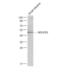 Anti-NDUFS2 antibody