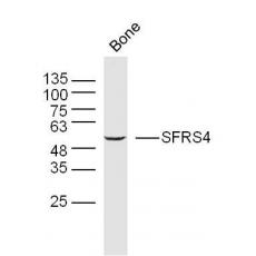 Anti-SFRS4 antibody