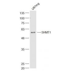 Anti-SHMT1 antibody