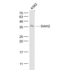 Anti-SIAH2 antibody