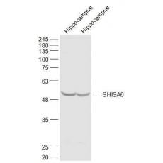 Anti-SHISA6 antibody