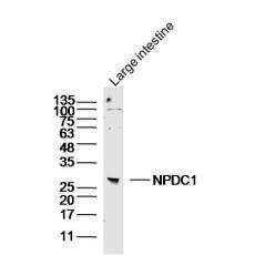 Anti-NPDC1 antibody