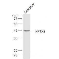 Anti-NPTX2 antibody