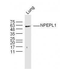 Anti-NPEPL1 antibody