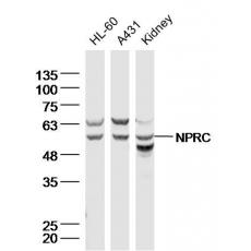 Anti-NPRC antibody