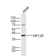 Anti-NPY2R antibody