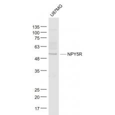 Anti-NPY5R antibody