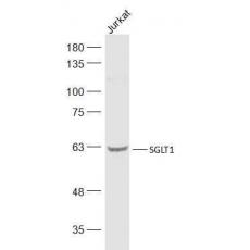 Anti-SGLT1 antibody