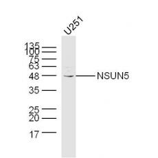 Anti-NSUN5 antibody