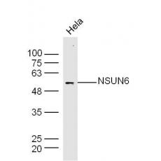 Anti-NSUN6 antibody